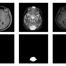 mr. deepfake|Image Segmentation / Obstruction masking 